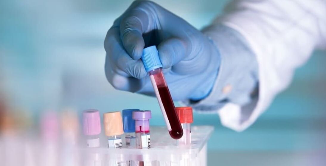 kako alkohol utječe na krvni test