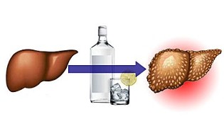učinci alkohola na jetru